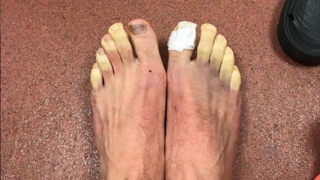 Se le congelan los dedos de los pies al jugador del Liverpool Adam Lallana y pide consejo Se le congelan los dedos de los pies al jugador del Liverpool Adam Lallana y pide consejo