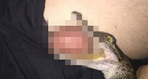 Cocodrilo muerde un testículo a un hombre en Australia Cocodrilo muerde un testículo a un hombre en Australia