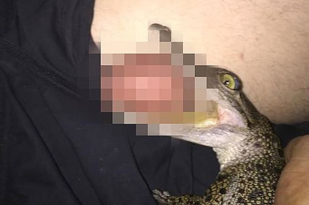 Cocodrilo muerde un testículo a un hombre en Australia Cocodrilo muerde un testículo a un hombre en Australia