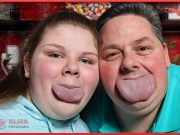 Fotos curiosas de personas con rasgos físicos acentuados Lenguas más anchas que unas sandalias es de lo que presumen padre e hija en esta fotografía