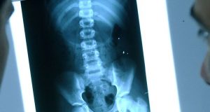 Madre descubre los piercings de su hija por una radiografía Madre descubre los piercings de su hija por una radiografía