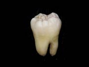 Unos constructores encuentran más de mil dientes en una pared Unos constructores encuentran más de mil dientes en una pared