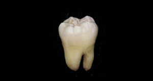 Unos constructores encuentran más de mil dientes en una pared Unos constructores encuentran más de mil dientes en una pared