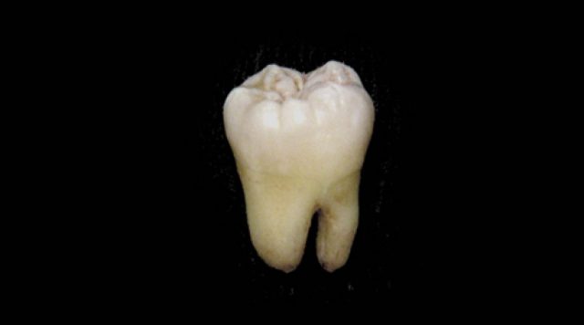 Unos constructores encuentran más de mil dientes en una pared