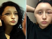 Casi muere por una alergia al tinte de pelo Casi muere por una alergia al tinte de pelo
