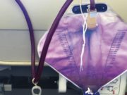 El extraño caso de la mujer que orina de color púrpura El extraño caso de la mujer que orina de color púrpura