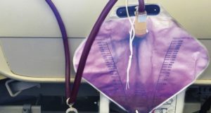 El extraño caso de la mujer que orina de color púrpura El extraño caso de la mujer que orina de color púrpura
